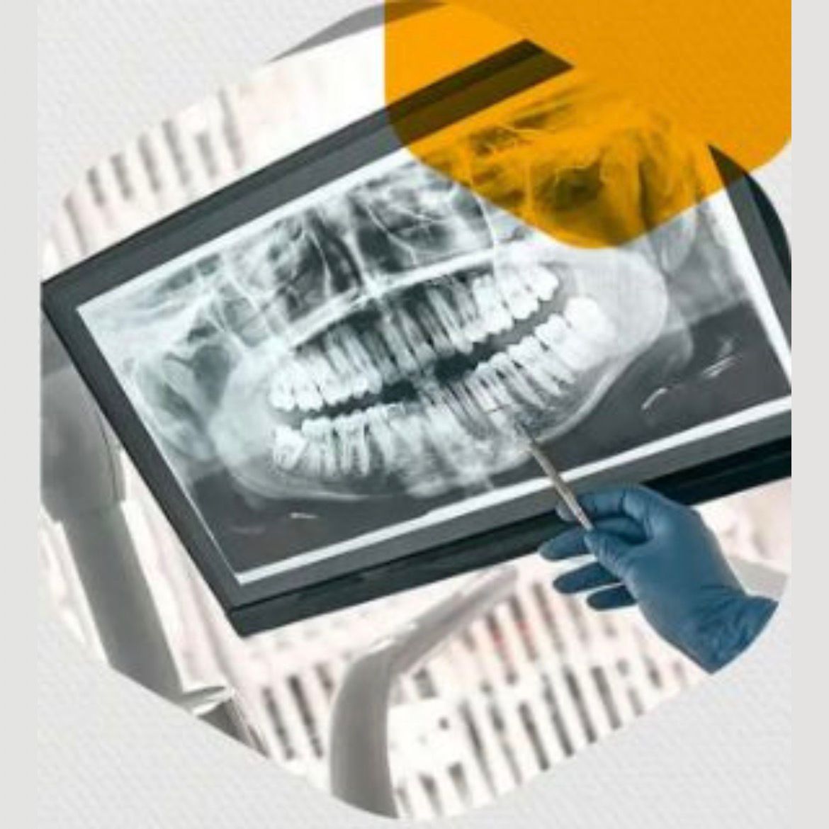 Digital X-Ray