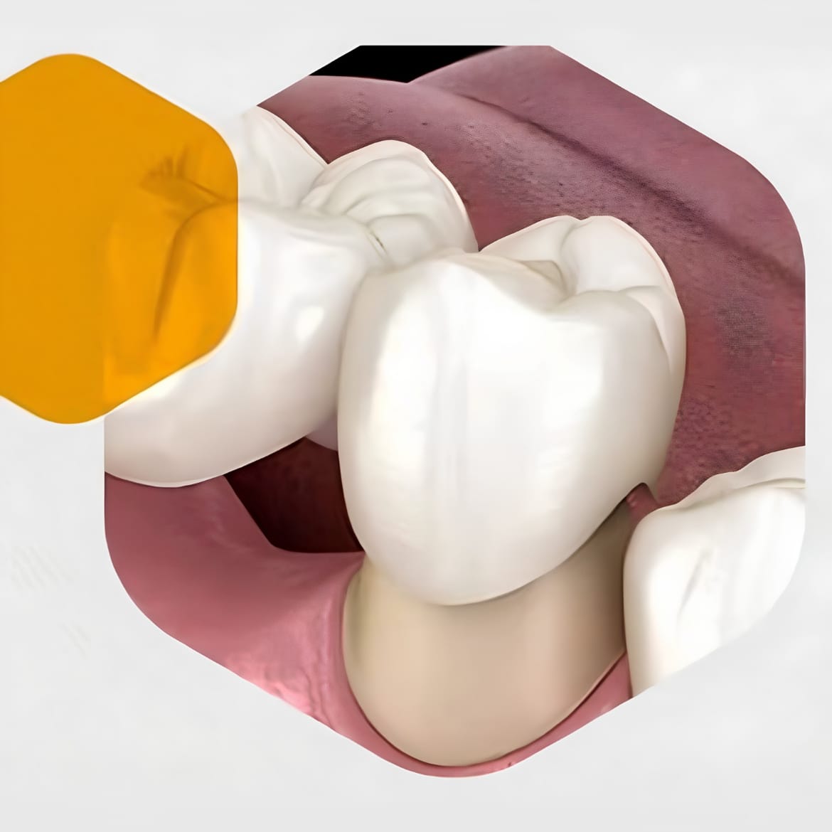 Dental Consultation
