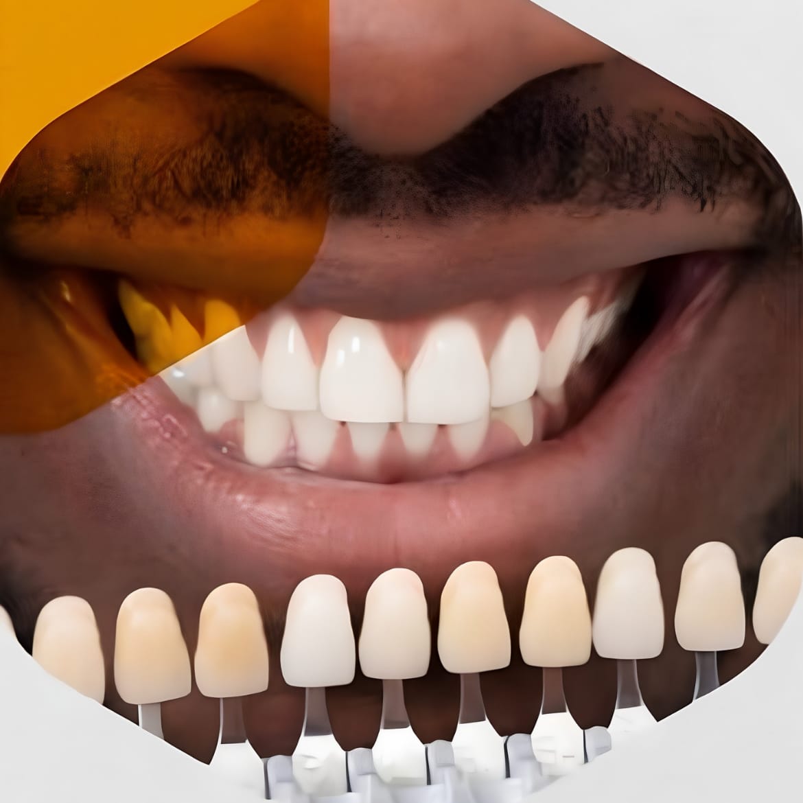Dental Jewelry